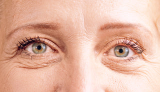 Close-Up of Womanβs Eyes After Skin Treatment