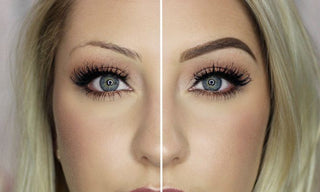 Costemic Treatment - Before & After Results