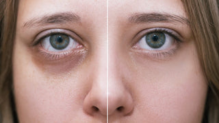 Woman Receiving Aesthetic Treatment at Leor Clinic