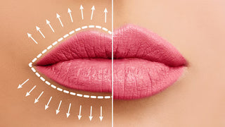 Lip Filler Treatment at Leor Clinic
