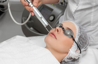 Q-Switched Nd: YAG Laser Treatment at Leor Clinic