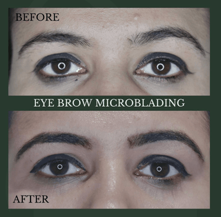 Eyebrow Microblading - Before & After Results