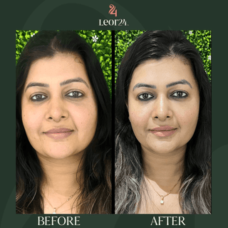 Leor Clinic Skin Treatment Options Screenshot