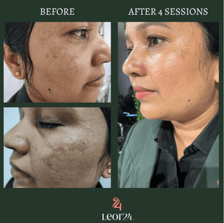 Leor Clinic Skin Treatment Services Screenshot