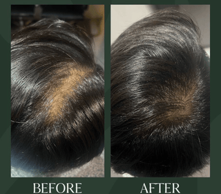 Hair Treatment - Before & After Results