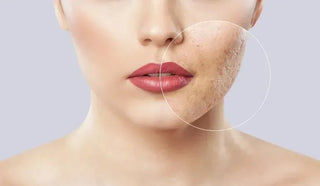 Anti Ageing Treatment - After & Before Results