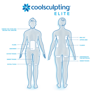 Body sculpting infographic