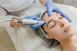Woman receiving laser treatment on forehead