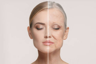 Anti Ageing Treatment - After & Before Results
