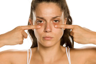 Treatment to Reduce Under Eye Bags at Leor Clinic