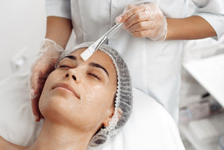 chemical peels