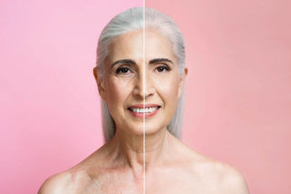 face lifting