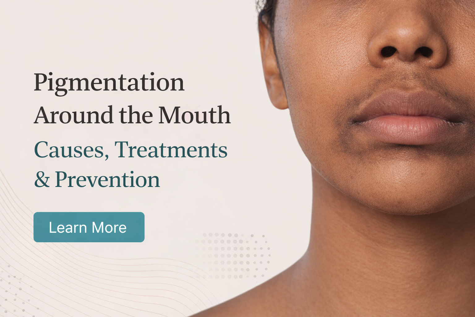 Pigmentation Around the Mouth: Causes, Treatments & Prevention